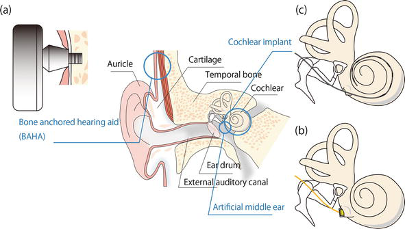���l(xi��ng)�� (t��ng)������ (t��ng)����ԭ���c����